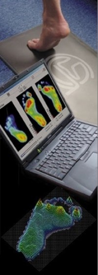 Gait scan analysis